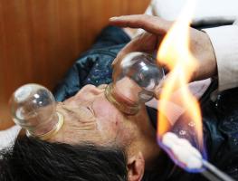 女子头发没吹干骑电动车导致面瘫 寒冷刺激引发神经损伤