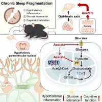 睡眠碎片化睡了约等于没睡 影响认知与健康