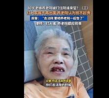 八旬瘫痪老人养老院内遭另一八旬老人殴打 八旬瘫痪老人养老院内遭另一八旬老人殴打，当事人女儿：母亲脸部淤紫红肿，嘴角持续渗血，经牌律师：打人者监护人、养老院应承担相应责任