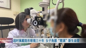 47岁女子戴隐形眼镜30年 双眼角膜长满新生血管！医生提醒