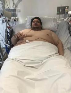 英国最胖男子去世用吊车搬运遗体 终年34岁，肥胖致器官衰竭