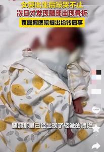 女婴在剖宫出生后一直大哭，次日婴儿集中洗澡时医生发现孩子腿部骨折