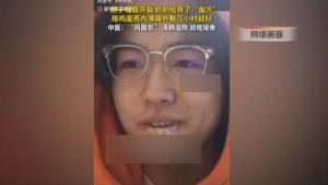 男孩嘴唇开裂奶奶给整了个偏方 鸡蛋壳内膜神奇愈合