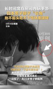 日本25歲男子沉迷手游致脖子長角 低頭族警鐘