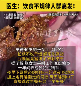 女子膽囊里竟有95顆結(jié)石 醫(yī)生：飲食不規(guī)律人群膽結(jié)石高發(fā)
