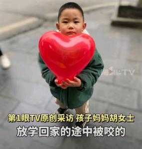 7歲男孩被3只惡犬撕咬一年后近況 仍在艱難康復(fù)中