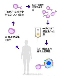 好醫(yī)?？蓤髧鴥?nèi)全部CART療法 高額治療費用不再愁