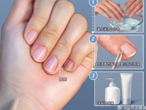 原来真的不能随便乱拔倒刺 那长了倒刺该怎么办