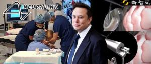 馬斯克機器人“開顱插針”僅1.5秒 未來腦機接口手術效率飛躍