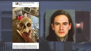 美国男子涉嫌出售人类遗骸被捕 恐怖场景震惊警方