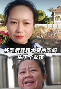 女子回应孕期容貌大变已生下女宝 顺转剖诞下爱女