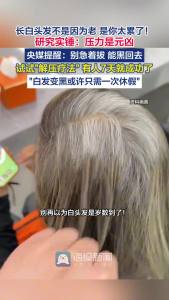 长白头发不是因为老 是你太累了 压力大导致白发增多