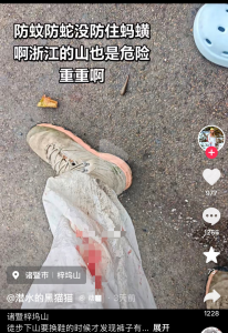 女子去山里徒步，下山时发现腿上一大片血迹：当时毫无察觉，血流了7个多小时！