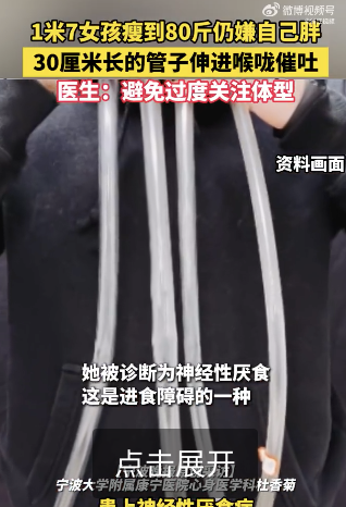 21歲女孩嫌胖將30cm管子伸喉嚨催吐