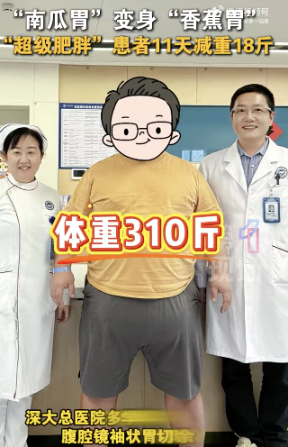 远超肥胖标准，310斤男子做切胃手术11天减重18斤！
