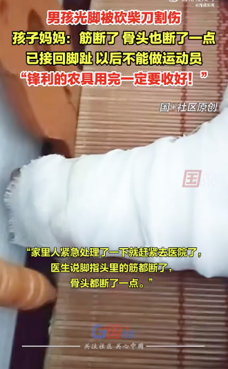 男孩光脚踩中砍柴刀割断脚趾：脚指头接回来了，以后不可以做运动员了