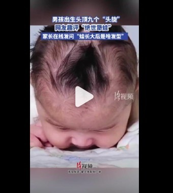 男娃出生头顶9个头旋 网友趣评“绝世犟娃”