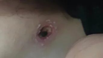 警惕！北京已有多人被叮咬，是什么毒虫？ 蜱虫活跃季需小心