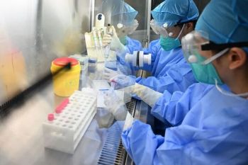汉坦病毒到底是什么 了解其传播与症状