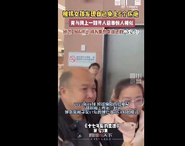 女孩身上6个伤疤同寻人启事一致 失散17年与家人相聚