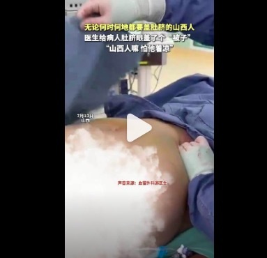 作念完手术大夫给病东谈主盖住肚脐眼