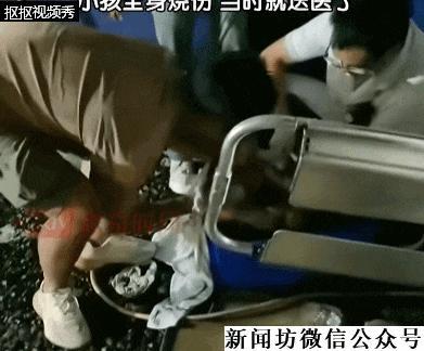 烧烤店内一男童不慎掉进炭堆，全身烧伤 安全防护缺失引发悲剧