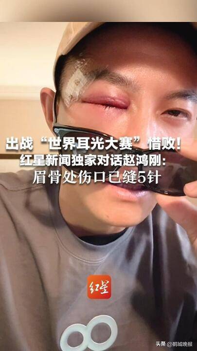 赵鸿刚：仍希望参赛 伤痛难阻比赛决心