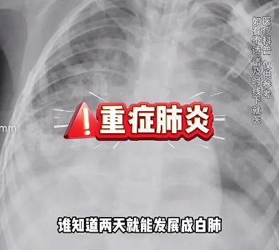 4歲女童甲流合并細(xì)菌感染"白肺" 病情急轉(zhuǎn)直下引發(fā)關(guān)注