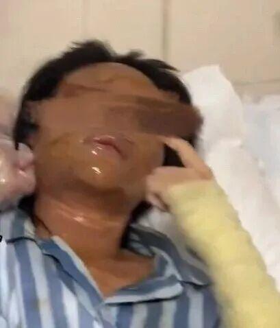 湖南一女主播收到炸弹包裹被炸伤 恶意报复事件引发热议