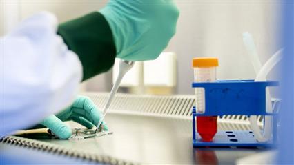 荷兰已有10人因感染西尼罗病毒死亡
