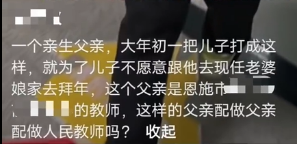 男孩不愿给后妈拜年 被亲爸打破头