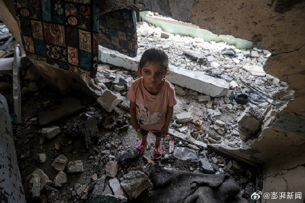 巴以冲突爆发两年：加沙已有超5000人截肢