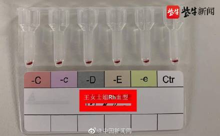 江苏发现2例全球罕见黄金血型 熊猫血全球不足50例