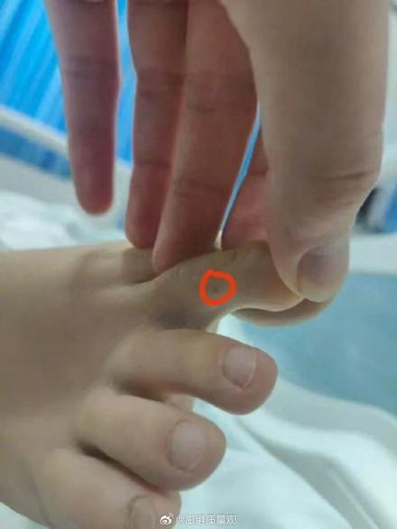 海南公示29家醫(yī)院蛇毒血清儲(chǔ)備情況 覆蓋多種抗蛇毒血清類型