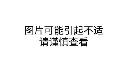 臭虫大爆发 如何识别与防治床虱问题