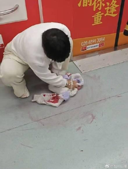 地铁吐血女孩已到华西治疗 罕见病患者求医路