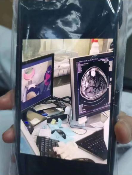 熊猫七七因肠梗阻送医  已会诊决定对“七七”实施手术