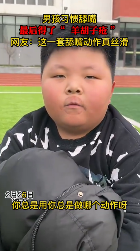 男孩习惯性舔嘴唇患上“羊胡子疮”