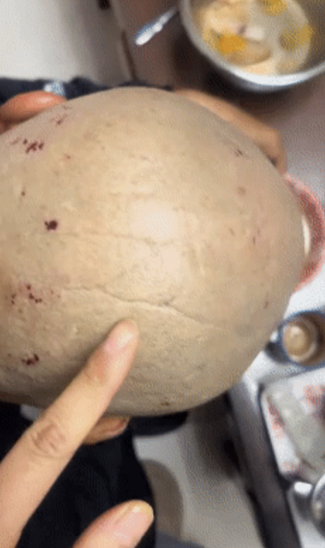 女儿回应老人花10元剃头满头血痂 父亲隐忍引发关注