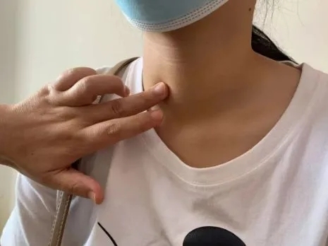 体检发现甲状腺结节？这份应对指南请收好