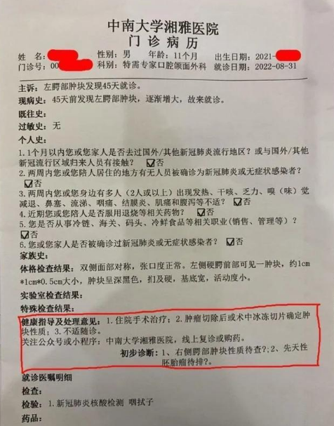 莲子壳粘嘴里湘雅医生诊断为肿瘤