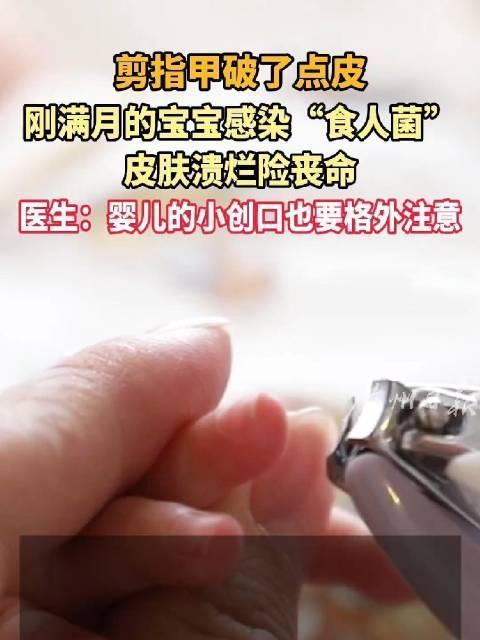 满月宝宝被剪破指甲感染食人菌 小伤口大危机