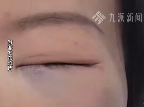 女子因房型不符掌掴前台后被打 网友:这算正当防卫?