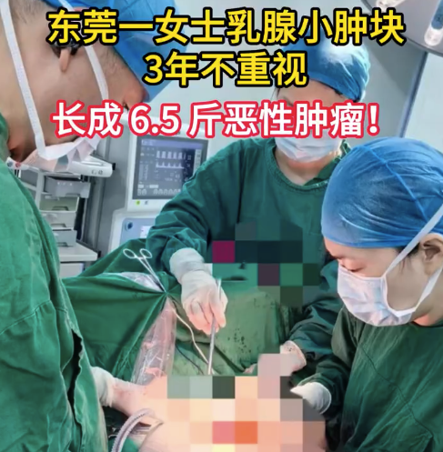 东莞一女士乳腺小肿块3年不重视,长成6.5斤恶性肿瘤!