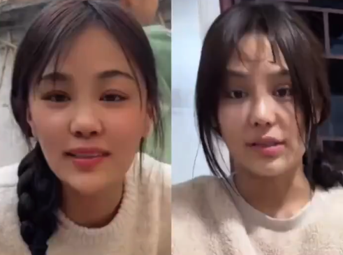 樊小慧承认整容：要为自己活一回