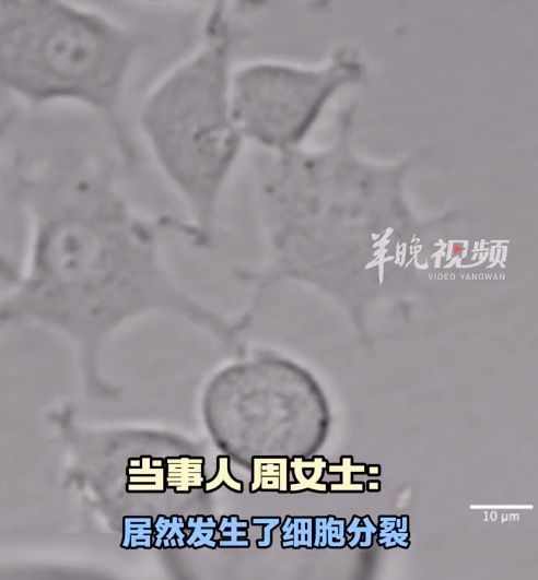 女生实验过程中意外拍到肿瘤细胞分裂全过程 