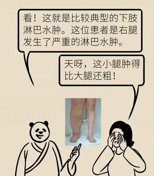 女子冬季遭蚊子叮咬，竟患上罕见丹毒