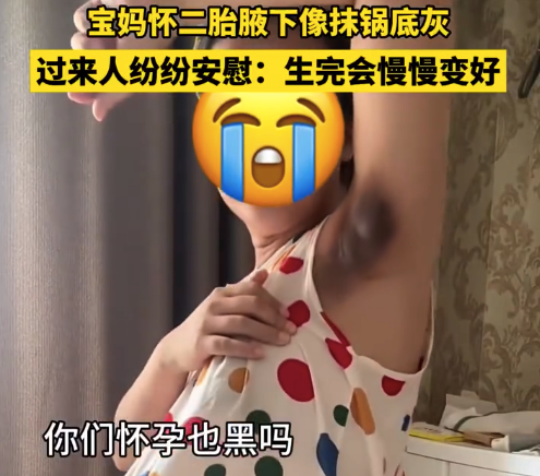 宝妈怀二胎腋下像抹锅底灰 为什么怀孕腋下会变黑