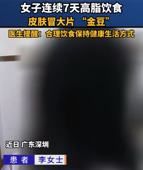 女子暴飲暴食皮膚出現(xiàn)大片黃疙瘩 醫(yī)生提醒