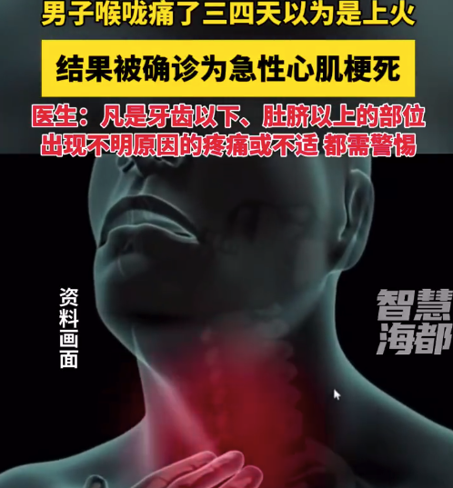 男子喉咙痛以为上火竟被确诊心肌梗死